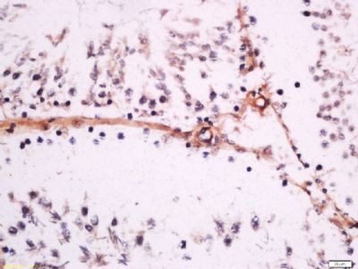 Endothelial lipase antibody