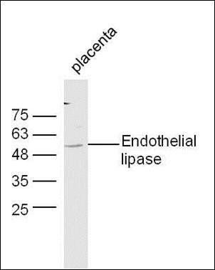 Endothelial lipase antibody