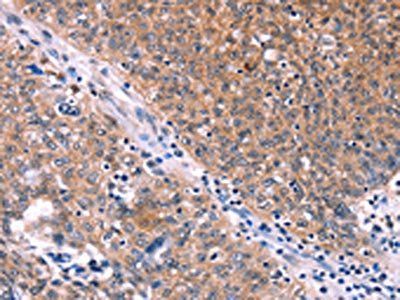 EDN1 Antibody