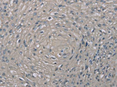 EDN1 Antibody