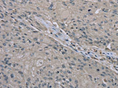 EDN1 Antibody