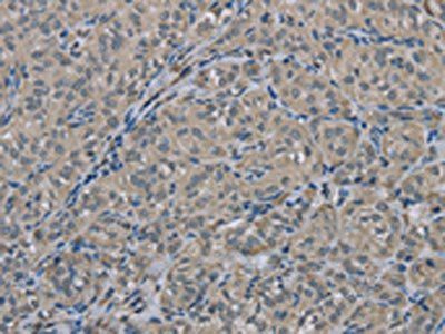 EDN1 Antibody