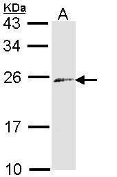 DPYD antibody [N1N2], N-term