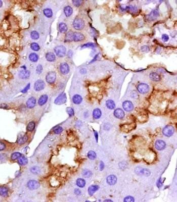 ET-1 Mouse Monoclonal Antibody