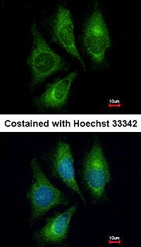 Endothelin 1 antibody