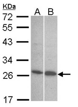 Endothelin 1 antibody