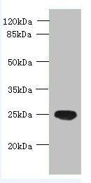 ENKD1 antibody