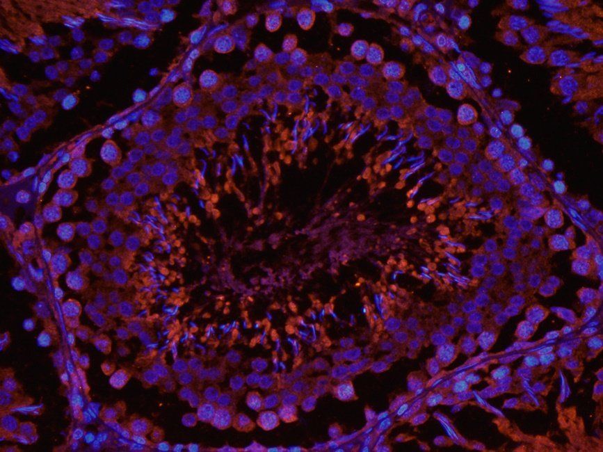 Enkephalin antibody