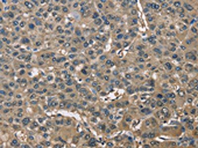 ENO1 Antibody