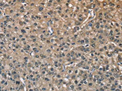 ENO1 Antibody