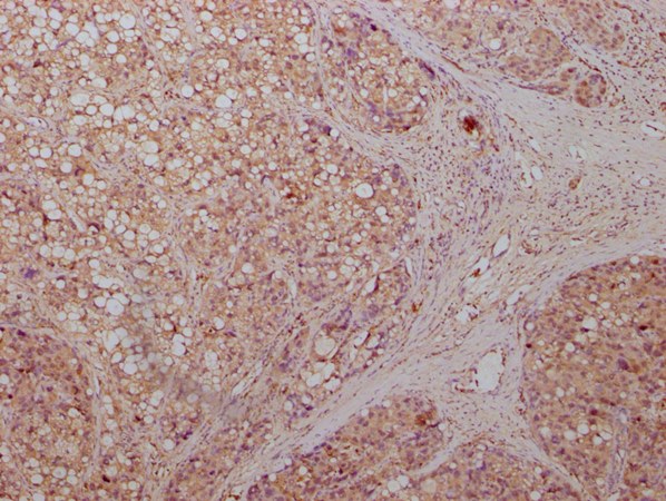 ENO1 antibody