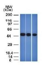NSE gamma (Neuron Specific Enolase, gamma) (Neuroendocrine Marker) Antibody