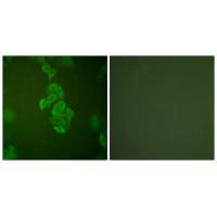 ENO2 Antibody