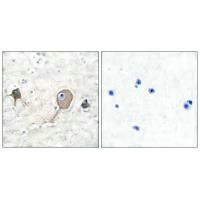 ENO2 Antibody