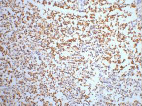 ENO2 Monoclonal Antibody