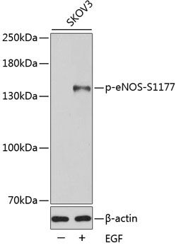eNOS (Phospho-S1177) antibody
