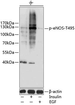 eNOS (Phospho-T495) antibody