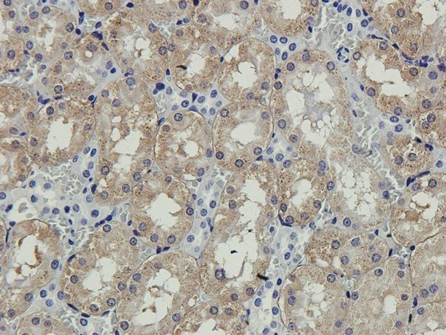 ENPP1 antibody