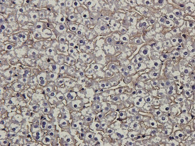 ENPP1 antibody