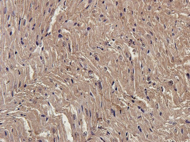 ENPP1 antibody