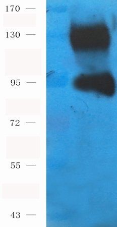 ENPP1 antibody