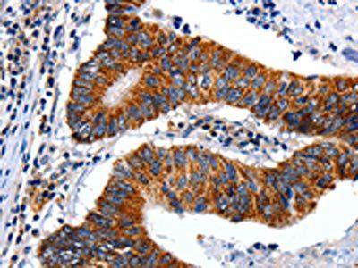 ENPP3 antibody