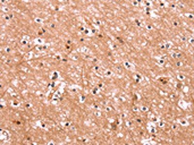 ENPP4 Antibody