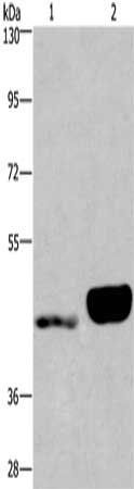 ENPP4 antibody