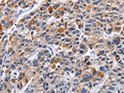 ENPP5 antibody