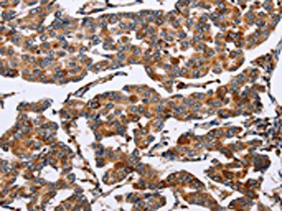 ENPP5 Antibody