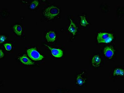 ENPP6 Antibody