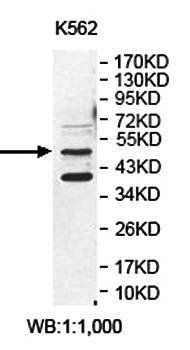 ENPP6 Rabbit Polyclonal Antibody