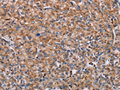 ENPP7 Antibody