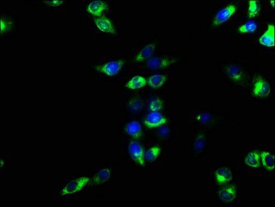 ENTPD1 Antibody