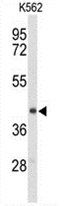 ENTPD2 antibody
