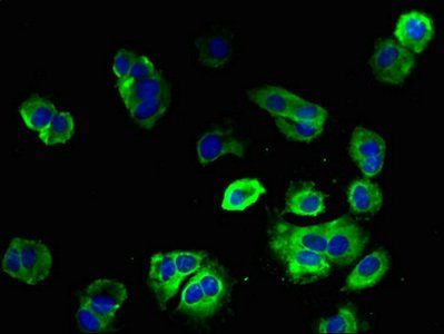 ENTPD3 Antibody