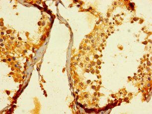 ENTPD3 Antibody