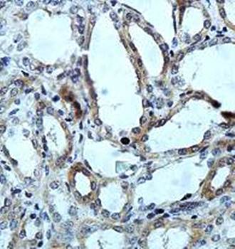 ENTPD4 Rabbit Polyclonal Antibody