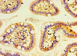 ENTPD5 antibody