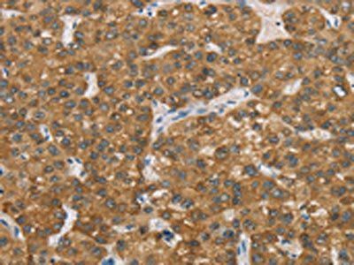 ENTPD5 Antibody