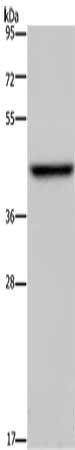 ENTPD5 Antibody