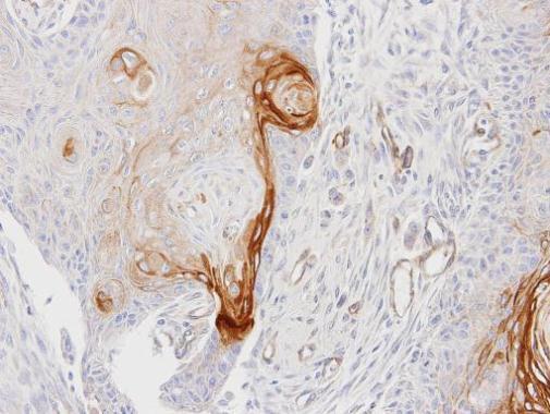 ENTPD6 antibody [N1C1]
