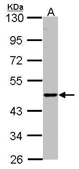 ENTPD6 antibody