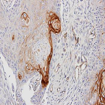 ENTPD6(CD39L2) antibody