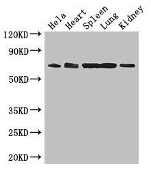 ENTPD7 antibody