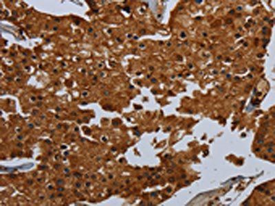 ENTPD7 Antibody