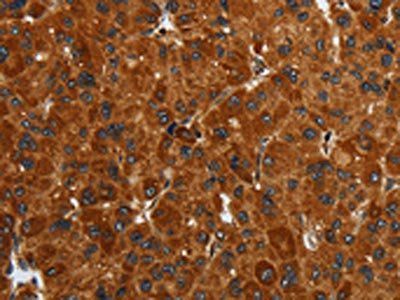 ENTPD7 Antibody