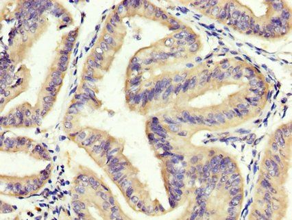EOMES Antibody