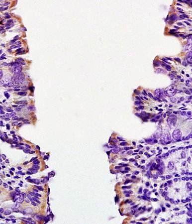 CCL24 Rabbit Polyclonal Antibody