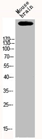 EP300 Antibody